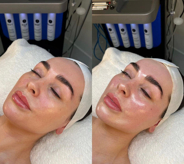 Studio Booth Hydrafacial work in Pittsburgh
