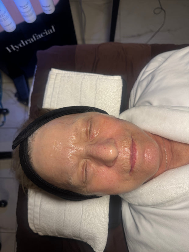 Studio Booth Hydrafacial work in Pittsburgh