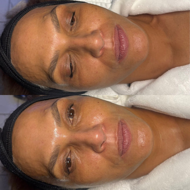 Studio Booth Hydrafacial work in Pittsburgh